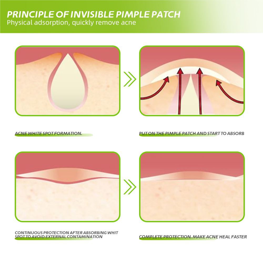 age spot patches age spot patches