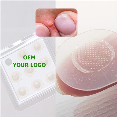 Microneedle Pimple Patch